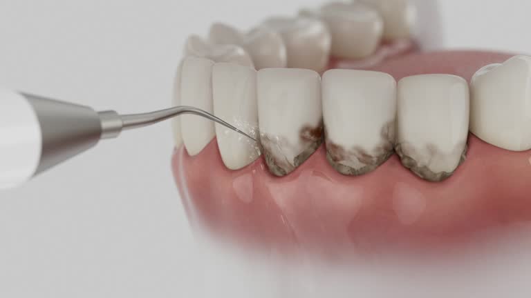 Reliable Dental Implants contractor in Raintree Plantation, MO by Smile Center Dentistry